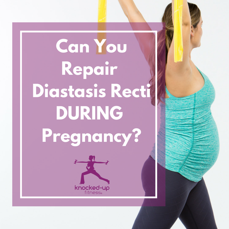 Can You Repair Diastasis Recti During Pregnancy? {Video} - Knocked-Up  Fitness® and Wellness