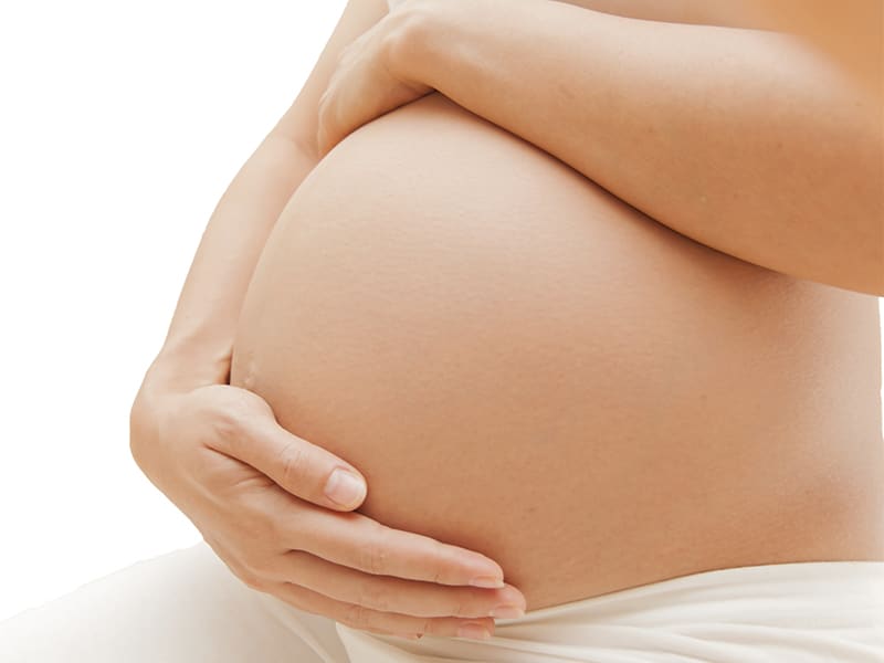 picture of a woman with an Abdominal Separation Pregnancy