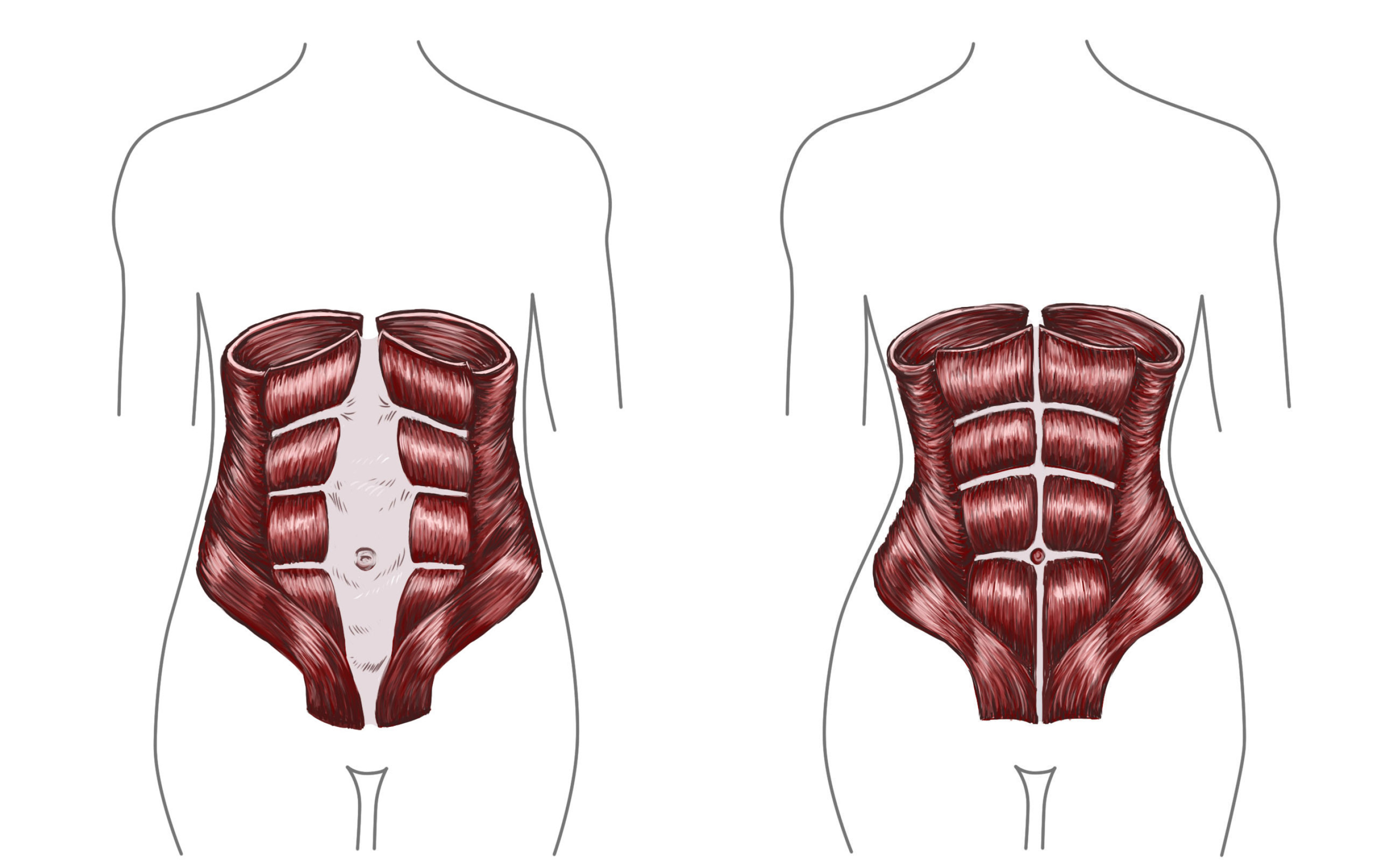 abdominal-muscle-strain-treatment-symptoms-and-causes