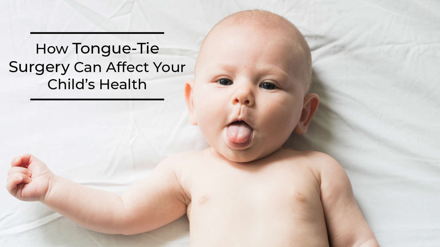 How TongueTie Surgery Can Affect Your Child’s Health KnockedUp