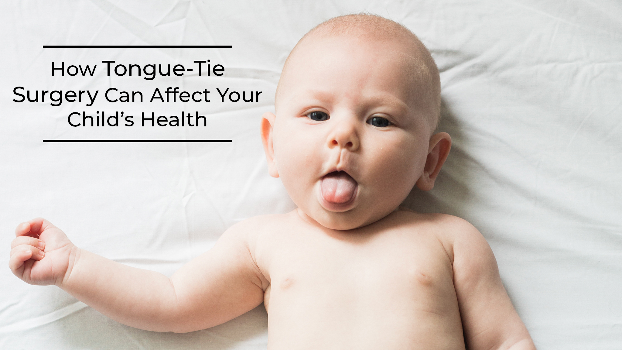How Tongue Tie Surgery Can Affect Your Child s Health LaptrinhX News